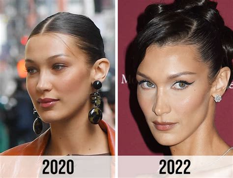 bella hadid buccal fat removal|Plastic surgeon reveals which celebrities had buccal fat removal ...